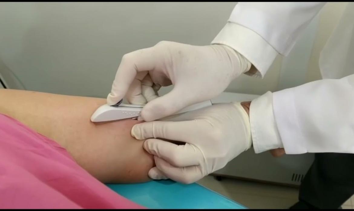 Saúde: capacitação de médicos garante aplicação de Implanon em 17 pacientes